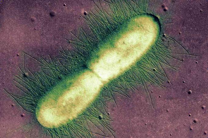 E. coli Bakterie
