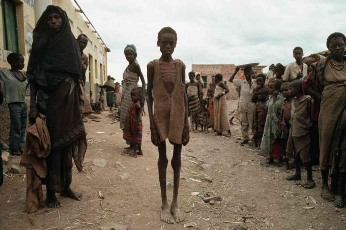 Ofre for hungersnød som følge af Somalias borgerkrig.