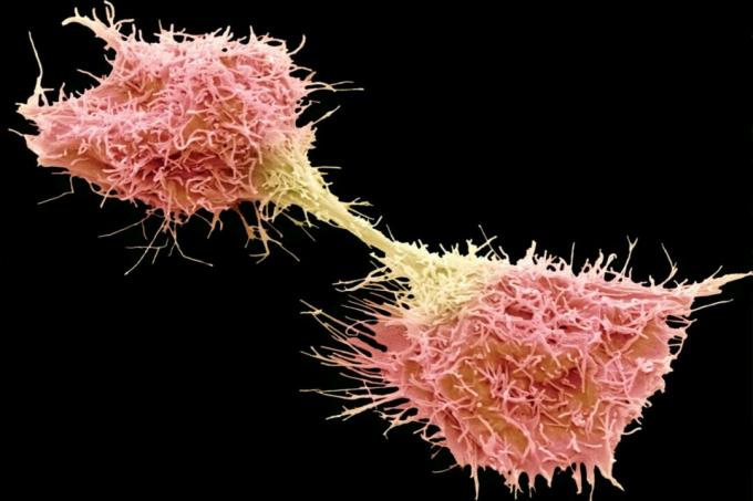 Fibrosarcomcancerceller deler sig.