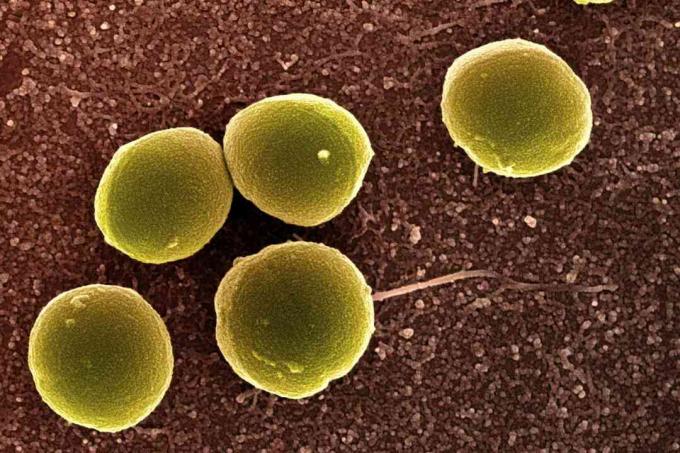 Staphylococcus aureus