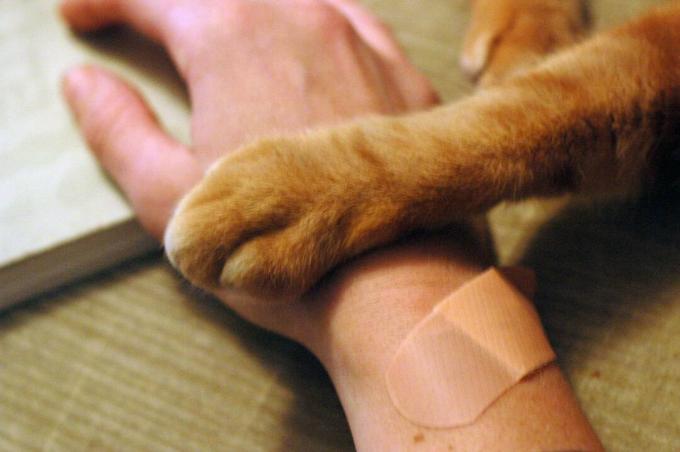 En bandaget menneskelig hånd og en kattepote.